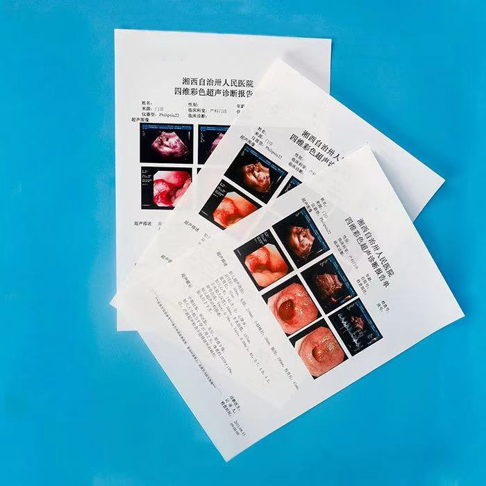 PACS 超聲診斷報(bào)告膠片